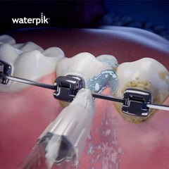 Orthodontic Tip