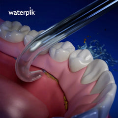 Implant Denture Tip